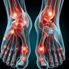 Hallux valgus. Medical Herb Lab