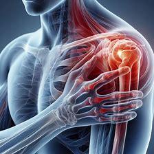 Kalkschulter. Medical Herb Lab