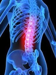 rücken-und kreuzschmerzen. MedicalHerb Lab